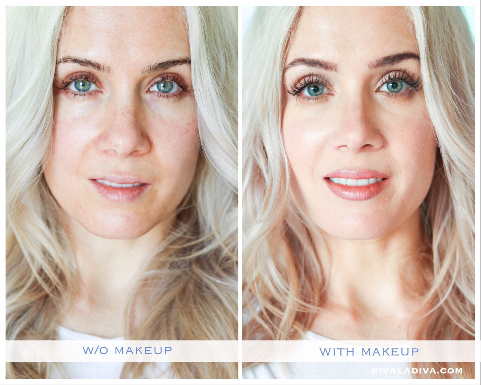 SKIN CANCER: 3 things I wish I knew