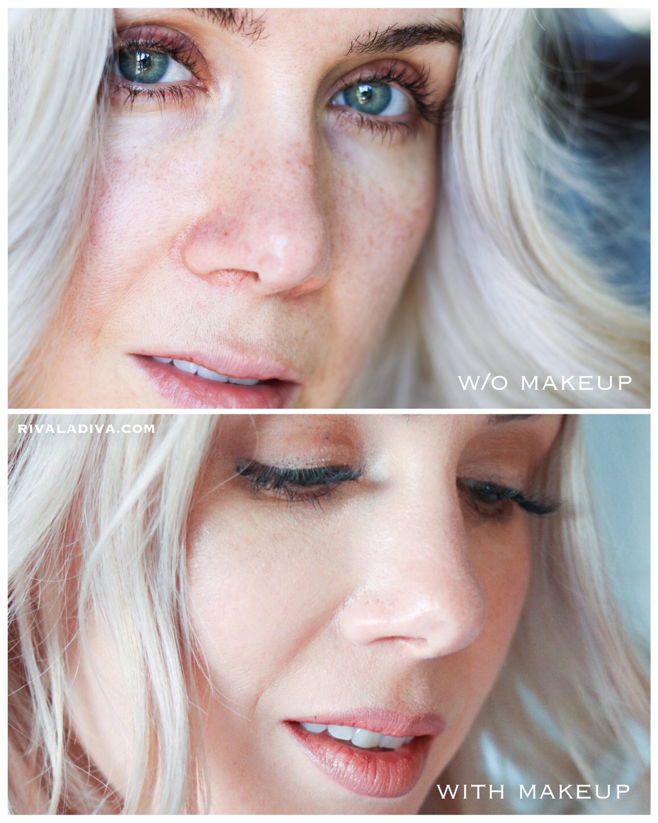 SKIN CANCER: 3 things I wish I knew